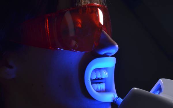 Teeth whitening