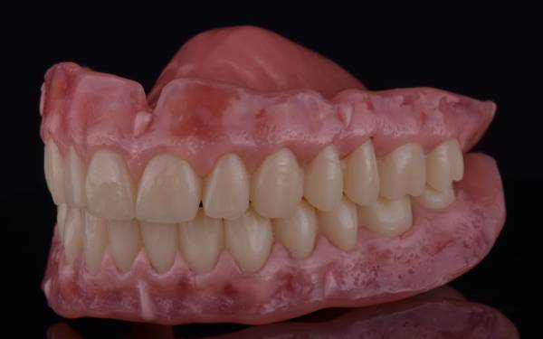 Digital complete dentures